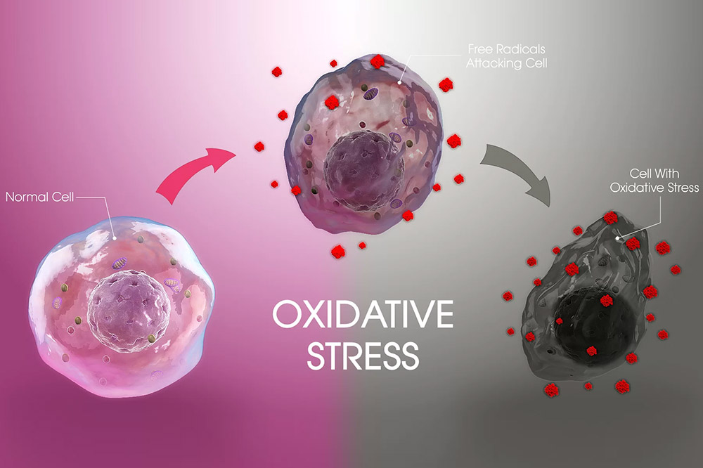 Oxidative Stress and Molecular Hydrogen